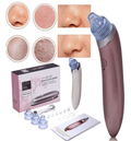 Extractor de Espinillas