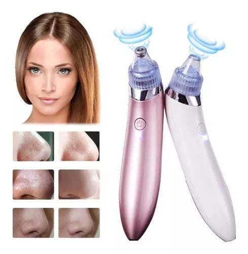 Extractor de Espinillas