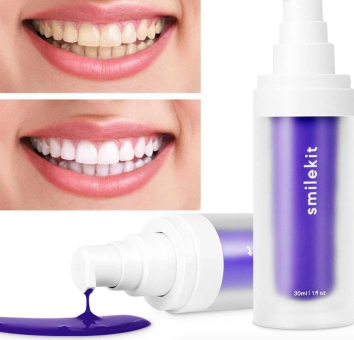 Espuma Blanqueadora SmileKit