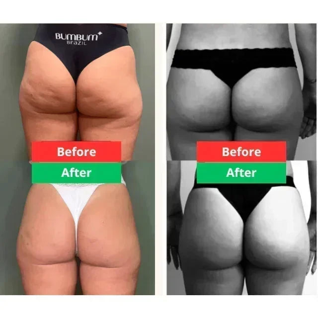 COMBO POPOZUDA | CREMA + SPRAY