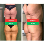 COMBO POPOZUDA | CREMA + SPRAY