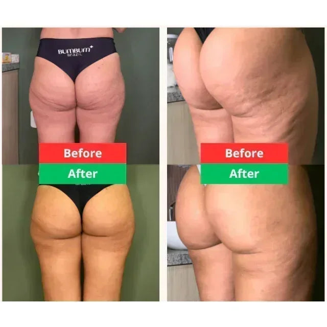 COMBO POPOZUDA | CREMA + SPRAY