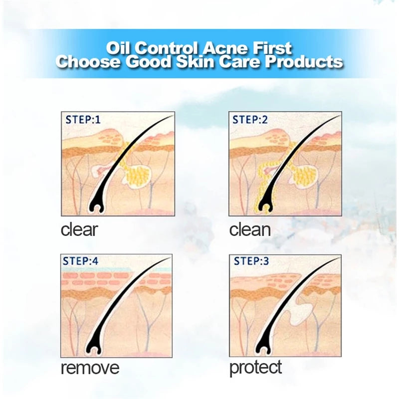COMBO ANTI ACNE BIOAQUA