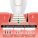 Depilador Láser Ipl