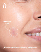 Parche Para Acné y Espinillas