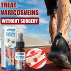SPRAY VARICOSE VEINS x2 UND