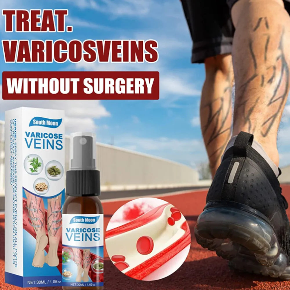 SPRAY VARICOSE VEINS x2 UND