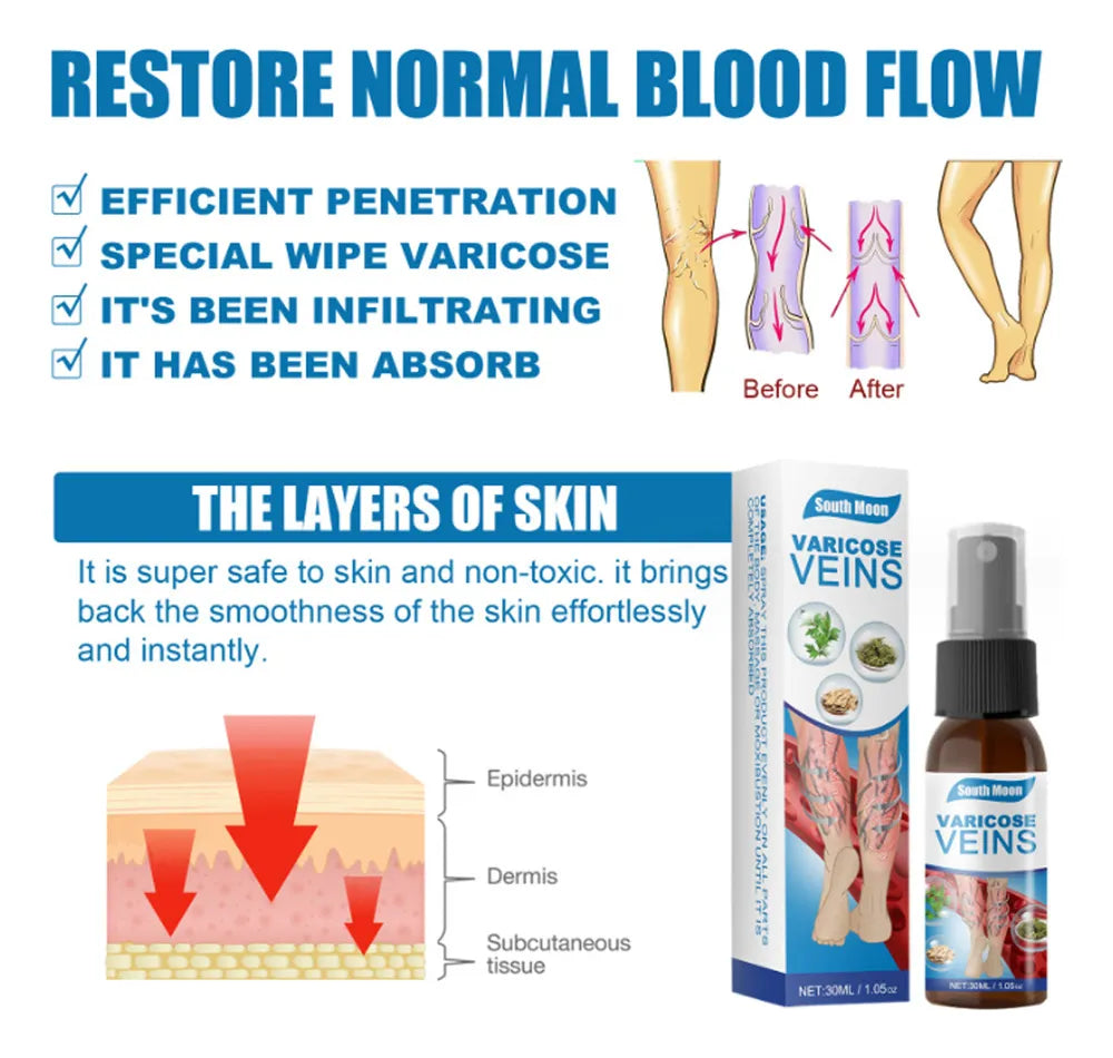 SPRAY VARICOSE VEINS x2 UND