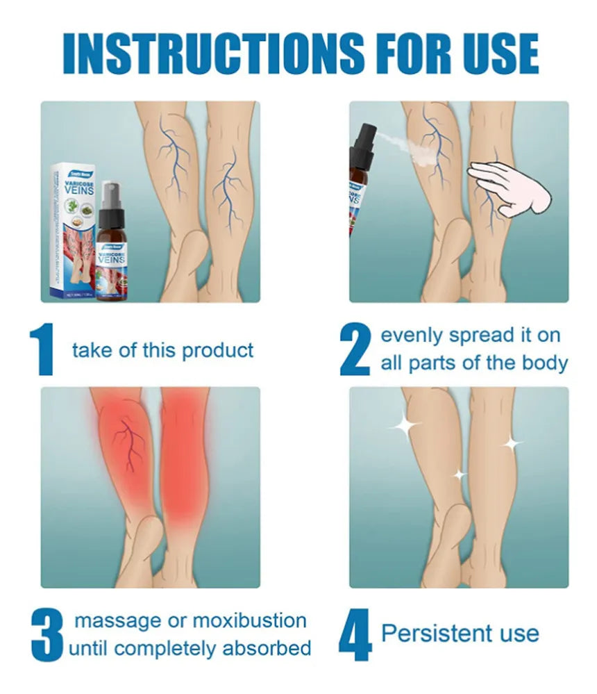 SPRAY VARICOSE VEINS x2 UND